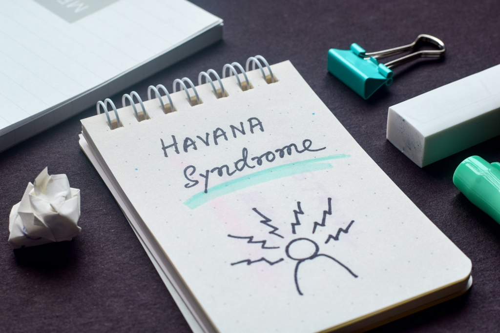 美斥巨資購神秘裝置測試 疑與「哈瓦那症候群」有關